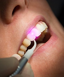 Patient undergoing laser gum disease treatment