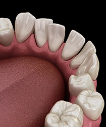 Illustration of gapped teeth