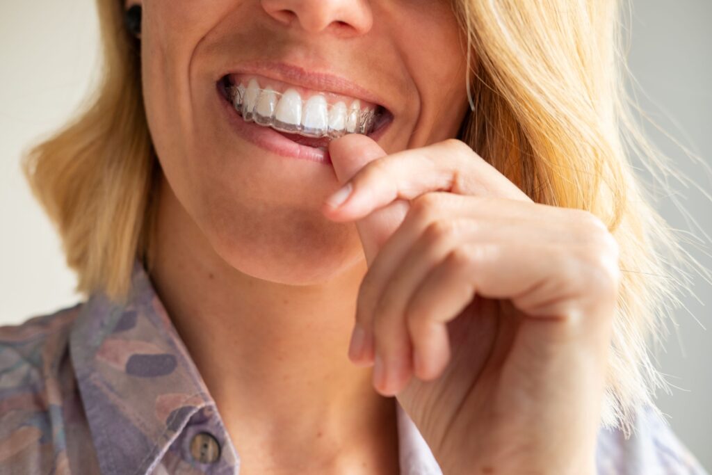 Nose-to-neck view of woman pressing Invisalign over upper arch